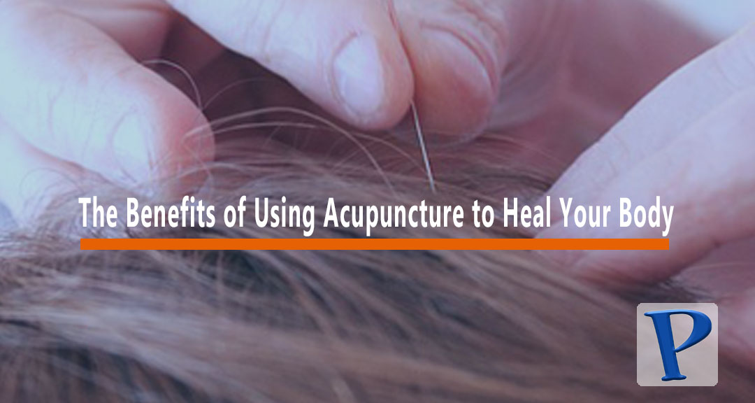 Featured image for The Benefits of Using Acupuncture to Heal Your Body