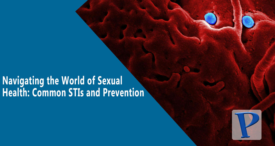 Featured image for Navigating the World of Sexual Health: Common STIs and Prevention